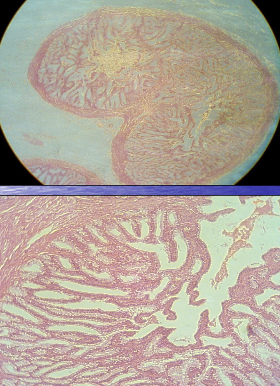 <p>What structure is depicted within the micrographs?</p><p>*Hint: This is a paired accessory sex gland that has many interconnecting folds providing a “fishnet” appearance.</p>