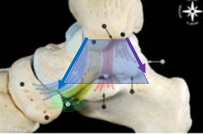 <p>Deltoid ligament- limits talar/subtalar abduction or eversion </p><ul><li><p>Very broad from front to back </p></li><li><p>Deep portion communicates with capsule </p></li><li><p>Described as up to 6 bands with considerable variability anatomically </p></li><li><p><mark data-color="yellow" style="background-color: yellow; color: inherit;">Anterior part is tight in plantar flexion </mark></p></li><li><p><mark data-color="yellow" style="background-color: yellow; color: inherit;">Middle portion in neutral </mark></p></li><li><p><mark data-color="yellow" style="background-color: yellow; color: inherit;">Posterior portion tight in Dorsiflexion </mark></p></li></ul><p>Surface Anatomy Hack- Slide off of the medial malleolus with your thumb and finger.  Notice how the separate.  This is the broad Deltoid ligament</p><p></p>