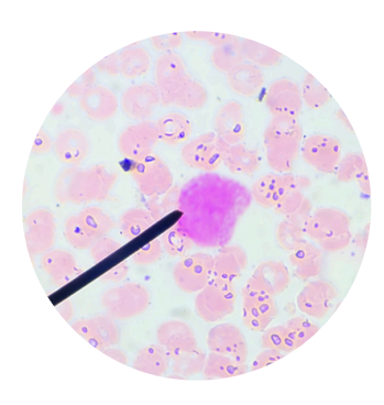 <p>what kind of white blood cells is this?</p>