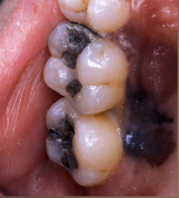 <p>what is the most likely diagnosis </p>