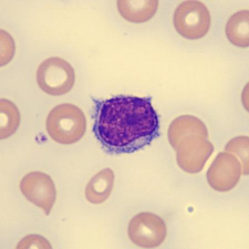 <p><strong>What is this leukocyte?</strong></p>