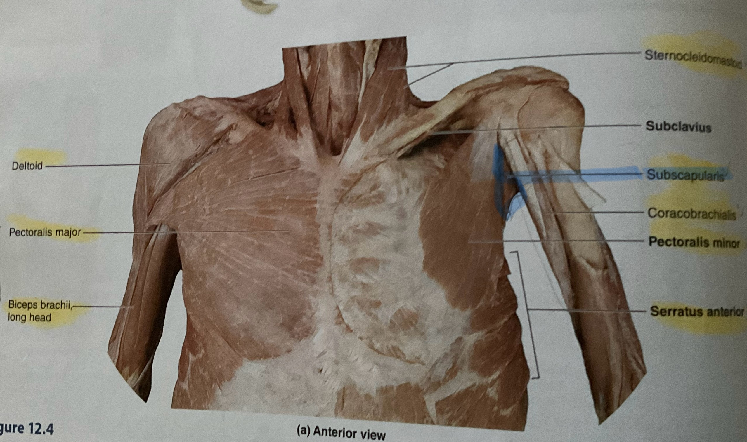 <p>Origin: Subscapular fossa of scapula<br> Insertion: Lesser tubercle of humerus<br>Action: Medially rotates glenohumeral joint </p>