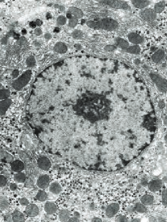 <p>where DNA is replicated &amp; transcribed to form mRNA</p><p></p>