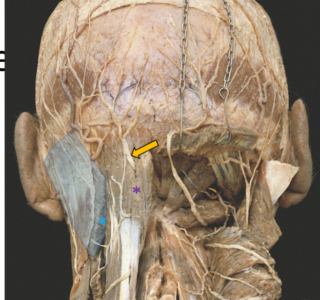 <p>What is the yellow arrow pointing at?</p>