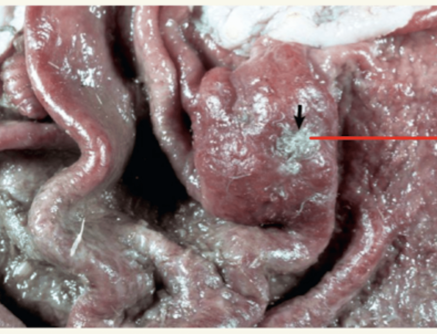 <p>¿diagnóstica morfológica y etiológica?</p>