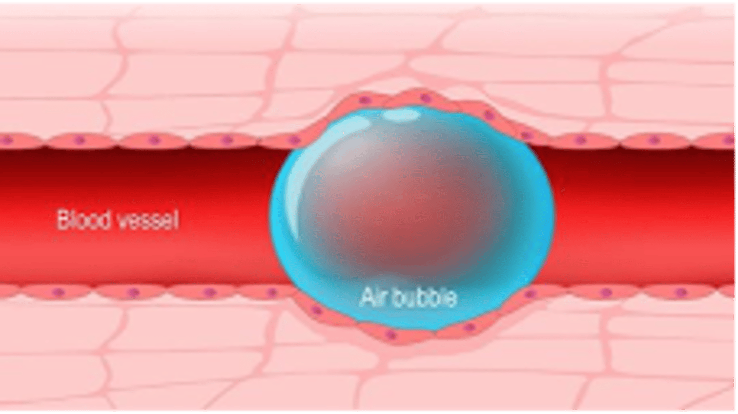 <p>occurs when a mass of matter in the bloodstream collects and creates an embolus</p>