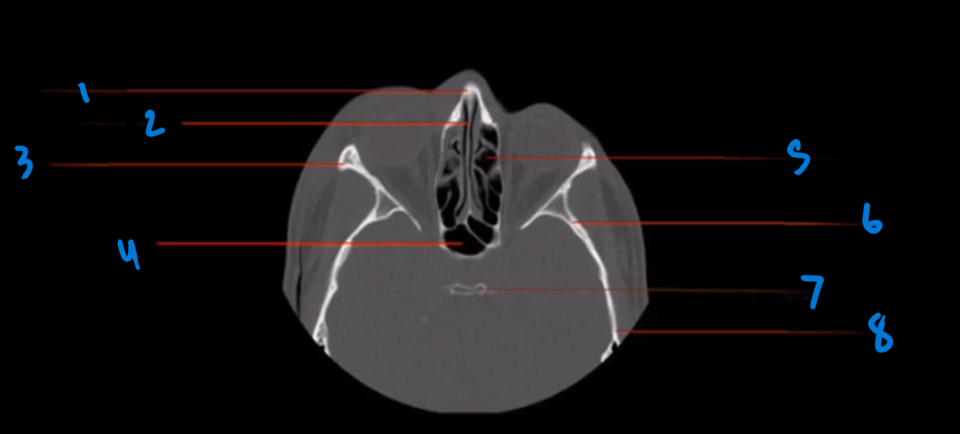 <p>What is landmark # 7 called?</p>