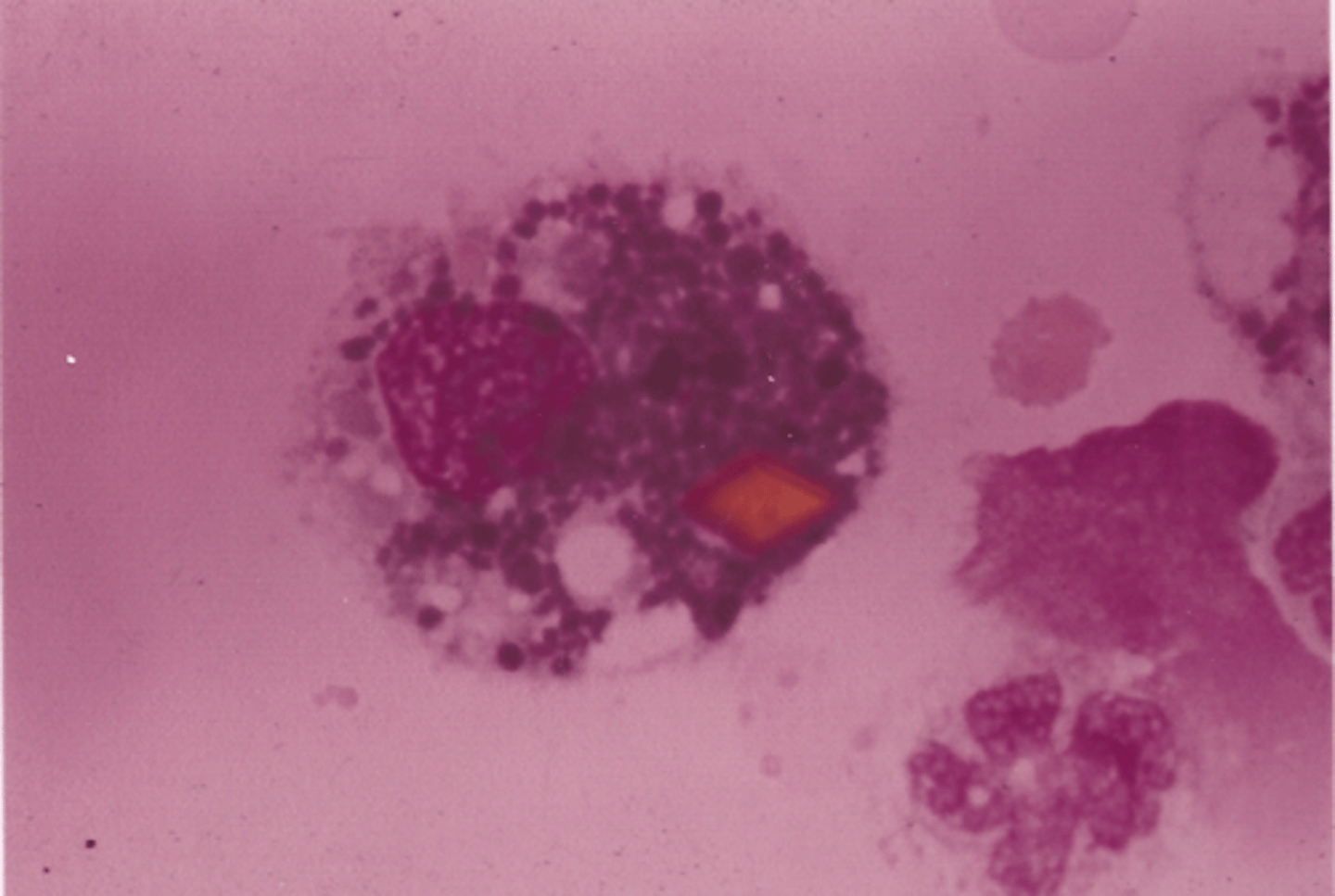 <p>Identify the cells in this body fluid</p>