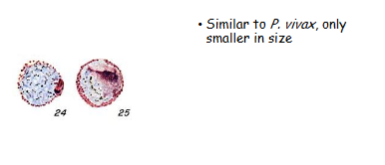 <p>What is the genus, species, and stage of this parasite?</p>