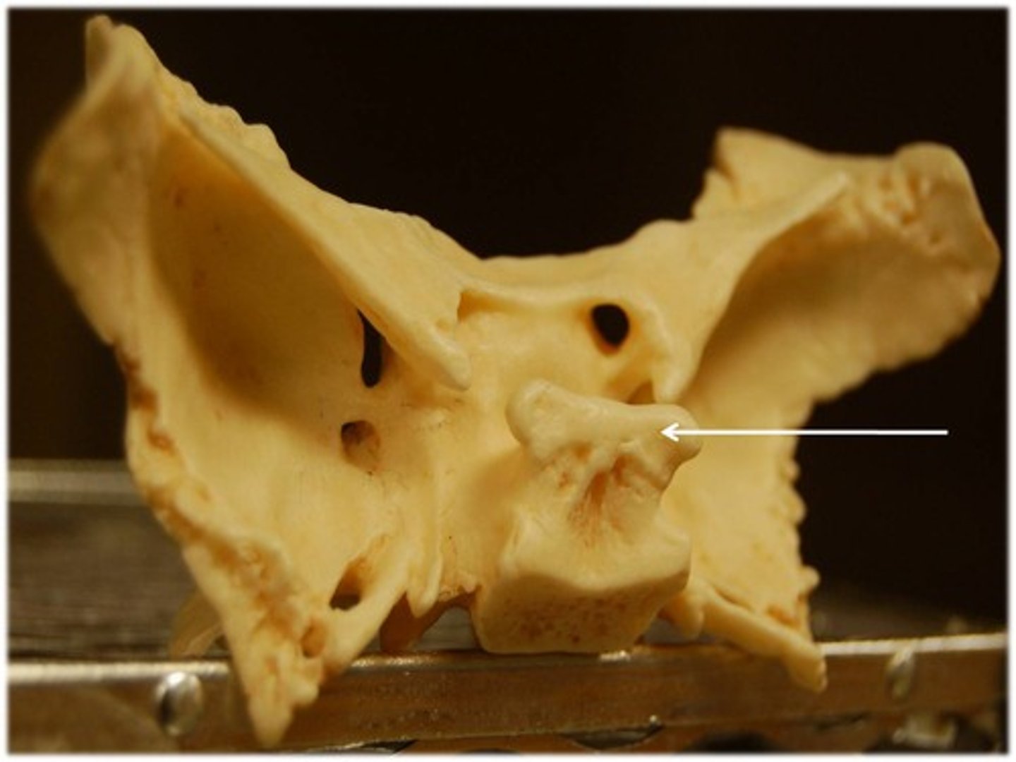 <p>The square plate of bone that forms the posterior boundary of the sella turcica</p>