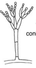 <p>Structure that produces conidia (ascomycete)</p>