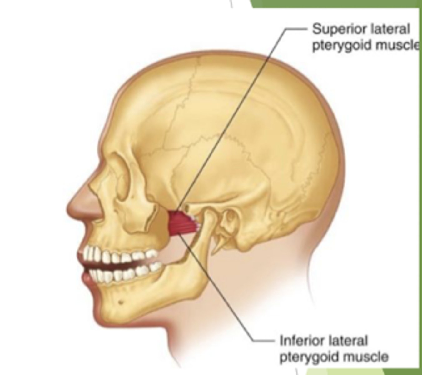 <p>origin: lateral aspect of the lateral pterygoid</p><p>insertion: TMJ capsule, disc, and mandibular neck</p>