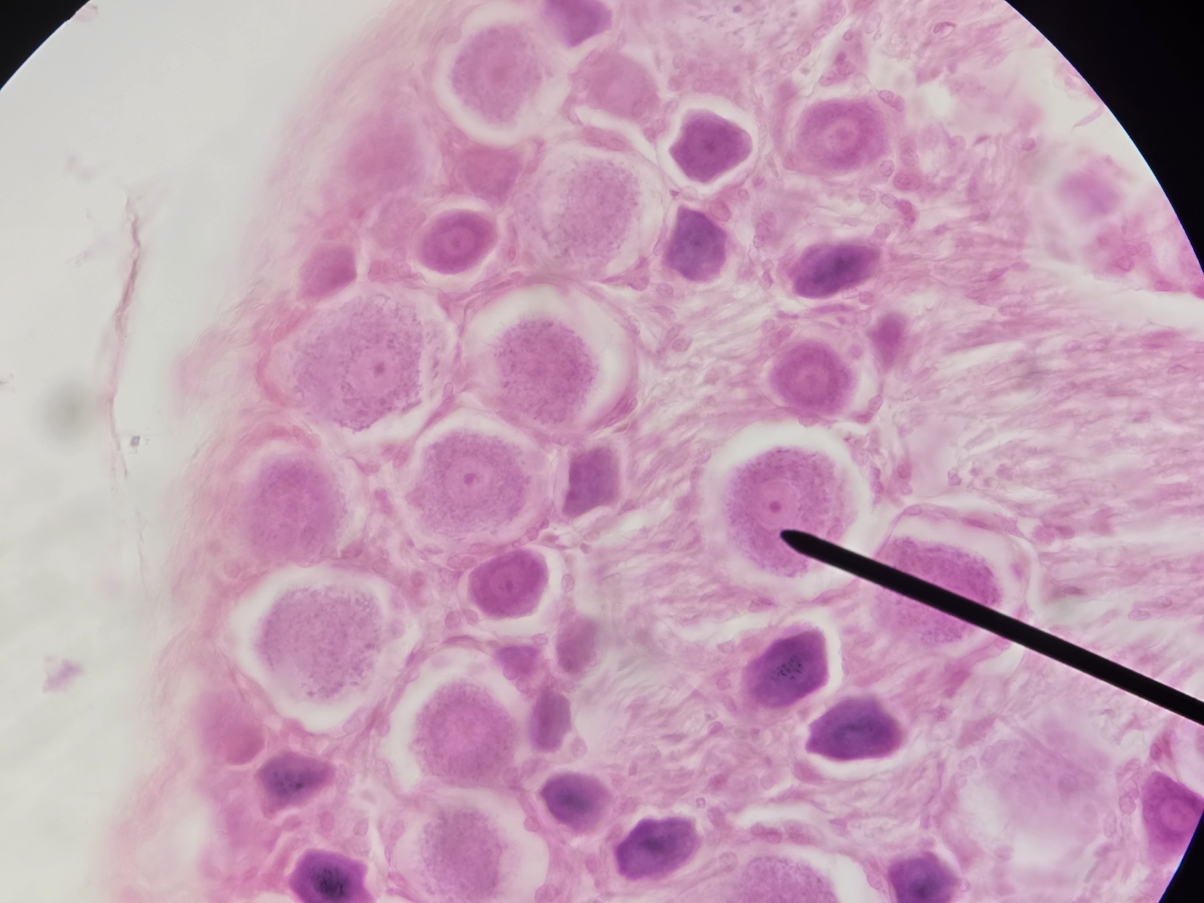 <p>Name Type of Neuron and its Function</p>