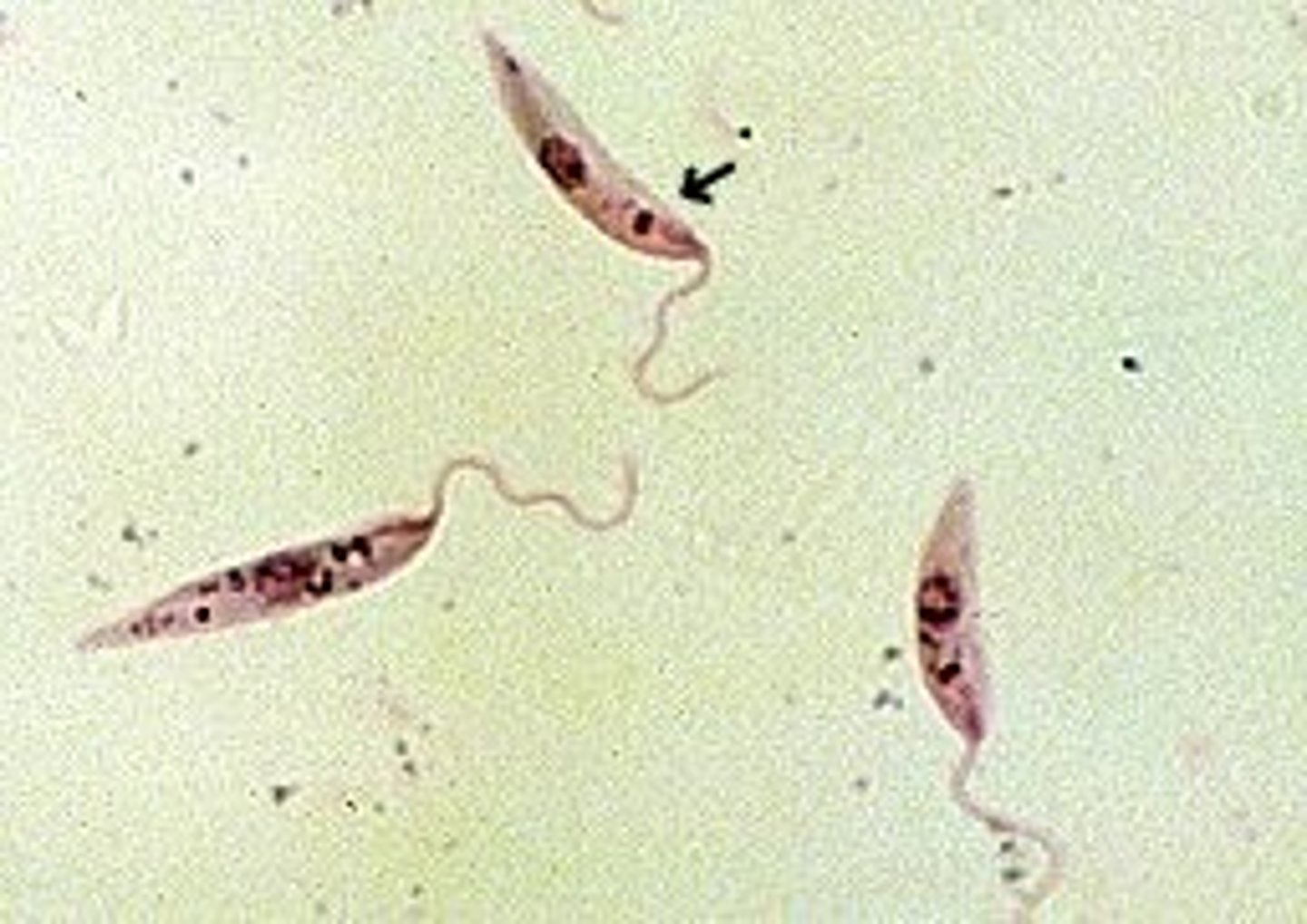 <p>spermy looking, circle nucleus in middle, bar-shaped kinetoplast near flagella end</p>
