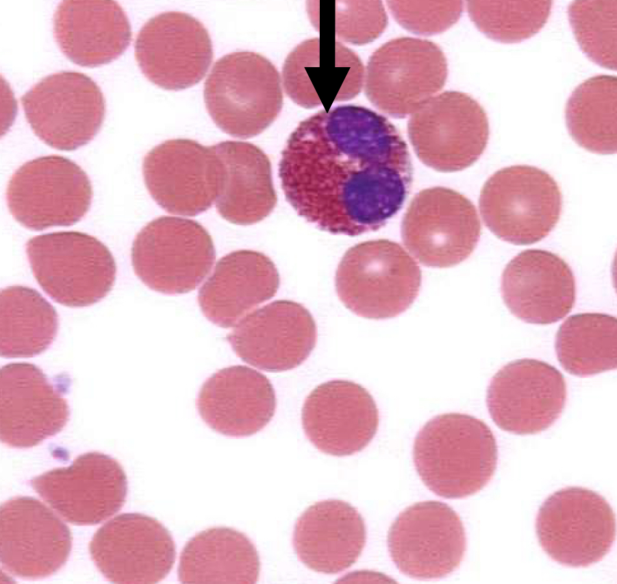 <p>What kind of blood cell is this?</p>