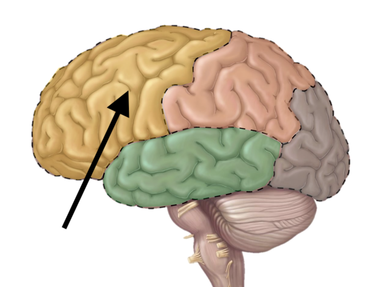 <p>Name the lobe</p>