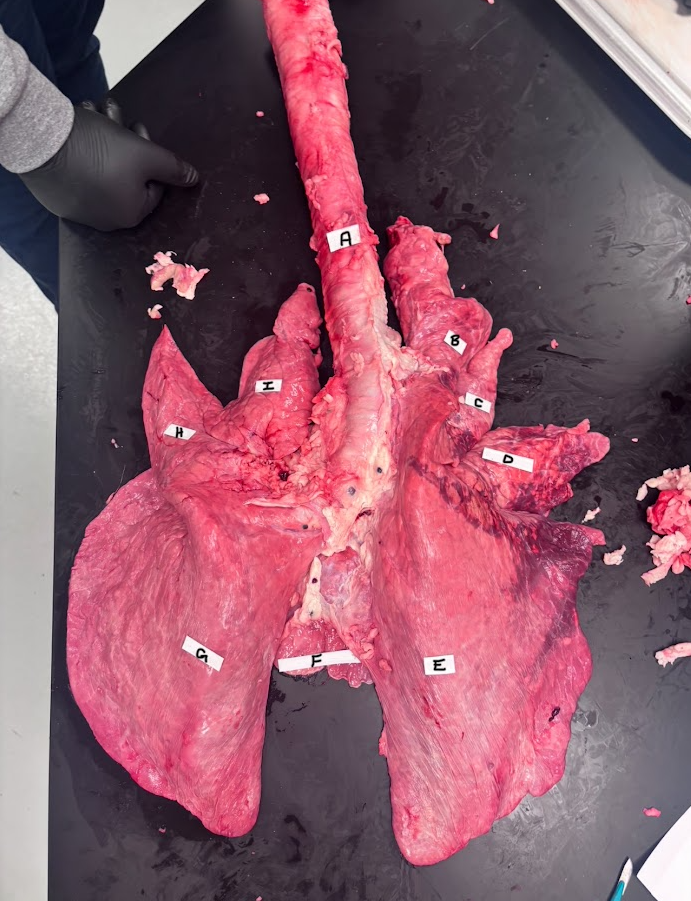<p>What does letter D represent on the lung?</p>