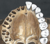 <p>socket (cavity) in bone that holds teeth</p>
