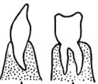 <p>Teeth set in sockets in the jawbone.</p>