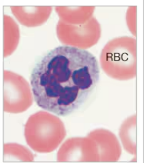 <p>What White Blood Cell is being displayed?</p>
