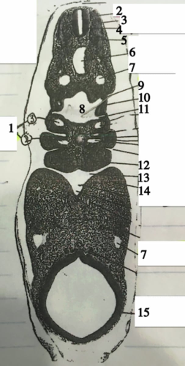 <p>#13</p>