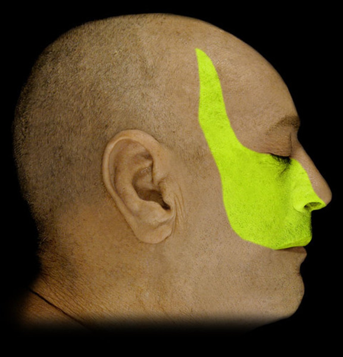 <p>general sensory below the eye</p>