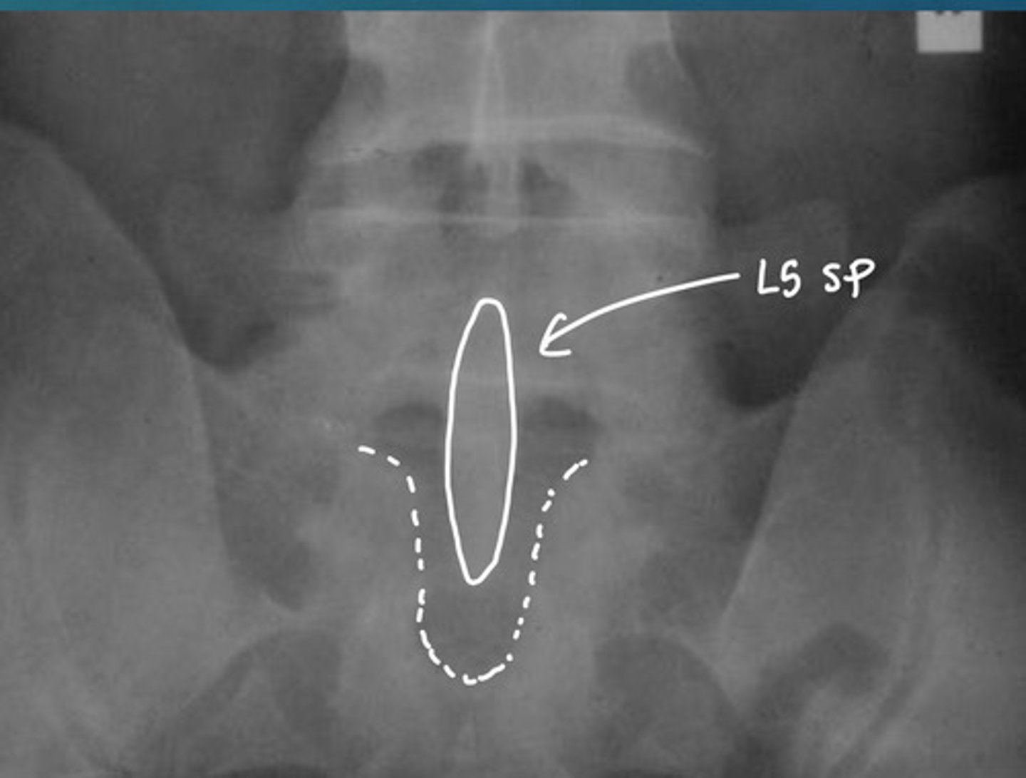 <p>What anomaly are we looking at here?</p>