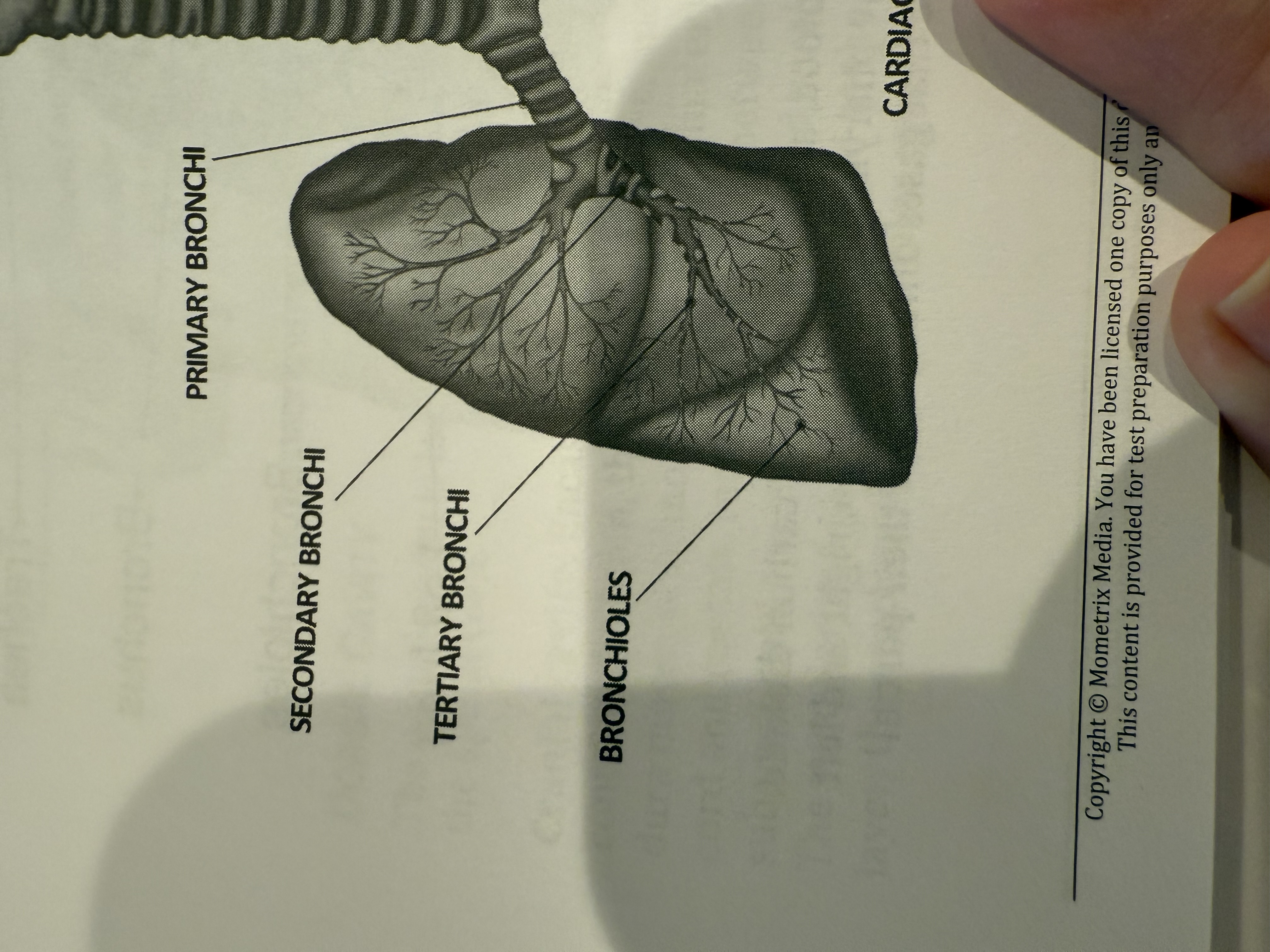 <p>Bronchioles</p>