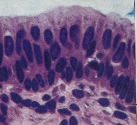 <p>stratified columnar </p>