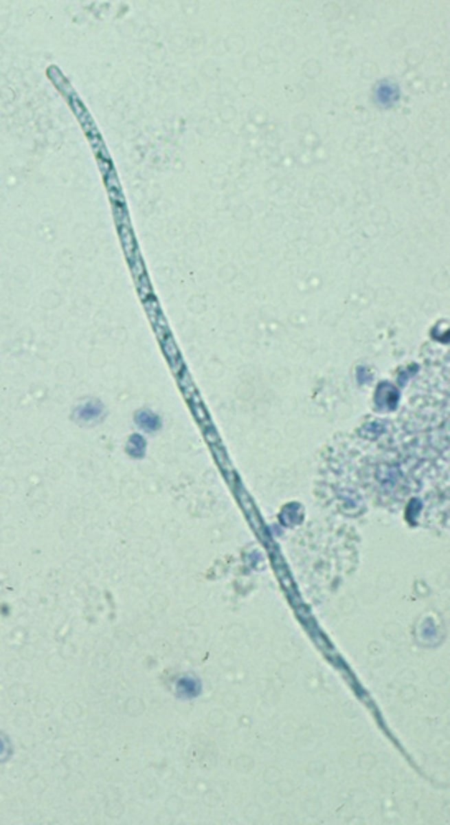 <p>What is the identity of this microfilaria observed on a canine's blood examination that is approximately 265 um in length and 5 um wide?</p>