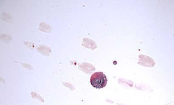 <p>Created when a wet, bloody surface comes in contact with a second surface. A recognizable image of all or a portion of the original surface may be observed in the pattern.</p>