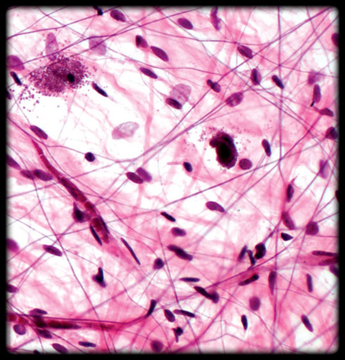 <p>- Loose connective tissue with an open framework.</p><p>- Contains a mix of collagen, elastic, and reticular fibers.</p><p>- Visible under the microscope as loosely arranged fibers and numerous cells (fibroblasts).</p><p>- Found under the skin, around organs, and between muscles.</p>