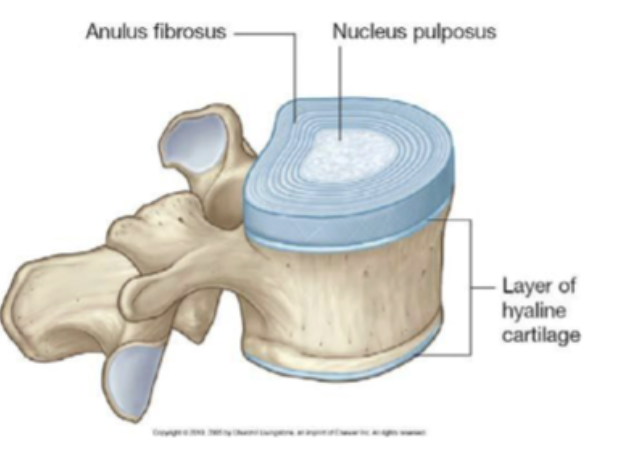 <p>discs are secondary cartilaginous joints that are in between vertebrae’s </p><p>ANNULUS FIBROSUS: </p><ul><li><p>outer layer </p></li><li><p>attaches to epiphyseal ring </p></li><li><p>keeps vertebra together </p></li><li><p>concentric lamellae of collagen </p></li><li><p>permits movement in all direction</p></li><li><p>resists excessive rotation</p><p>NUCLEUS PULPOSUS: </p></li><li><p>inner layer </p></li><li><p>surrounded by annulus fibrosus  </p></li><li><p>keeps vertebra apart </p></li><li><p>jelly consistency </p></li><li><p>shock absorber —&gt; disperses compressive forces </p></li></ul><p></p>