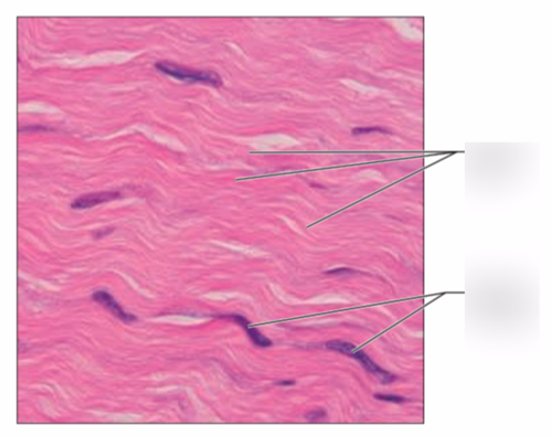 <p>Dense regular or irregular?</p>