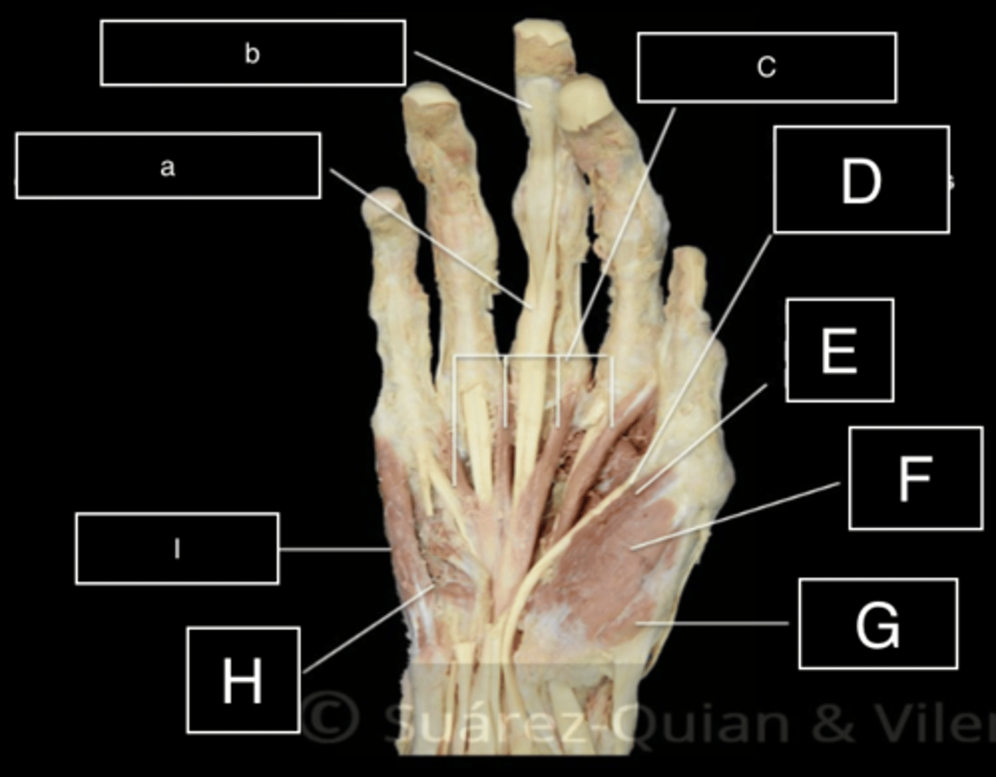 <p>ID muscle F- abducts thumb</p>