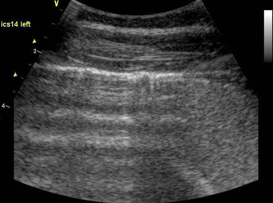 <p>What can be seen on this radiograph? Is it normal?</p>