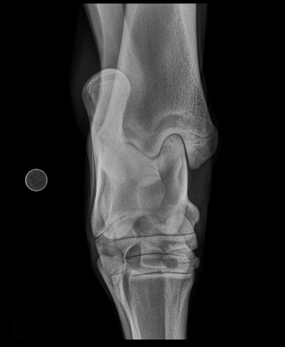 <p>Name the view and the anatomical region within the radiograph</p>
