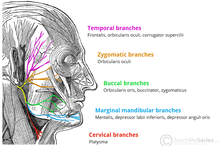 <ul><li><p>Mixed motor-sensory nerve</p><ul><li><p>motor info to the face</p></li><li><p>sensory (taste) info from anterior 2/3 of tongue</p></li></ul></li><li><p>Has four branches</p><ul><li><p>temporal, zygomatic</p><ul><li><p>motor info to muscles of the upper face</p></li><li><p>bilaterally innervated</p></li></ul></li><li><p>buccal, mandibular</p><ul><li><p>motor info to muscles of the lower face</p></li><li><p>unilaterally innervated</p></li></ul></li></ul></li></ul>
