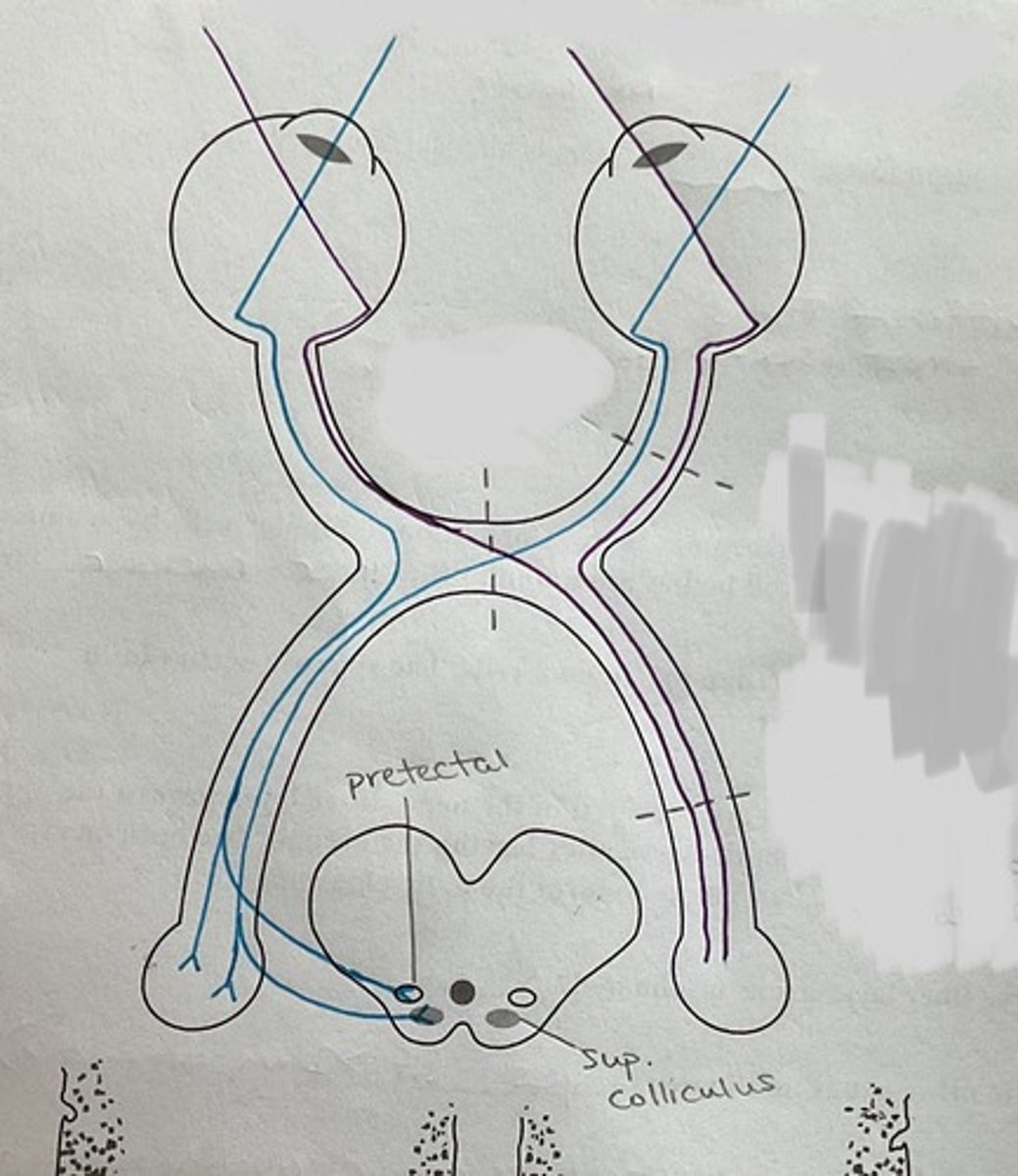 <p>(1) Fibers from the medial (nasal) side of each retina will cross</p><p>(2) Fibers from the lateral (peripheral) side of each retina will NOT cross</p><p>Fibers then split to form the optic tracts (so now divided into right and left visual fields)</p>