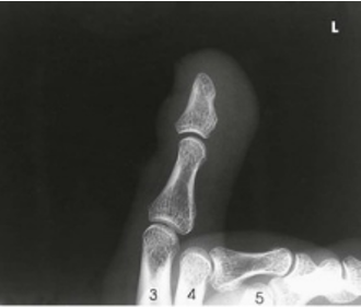 term image
