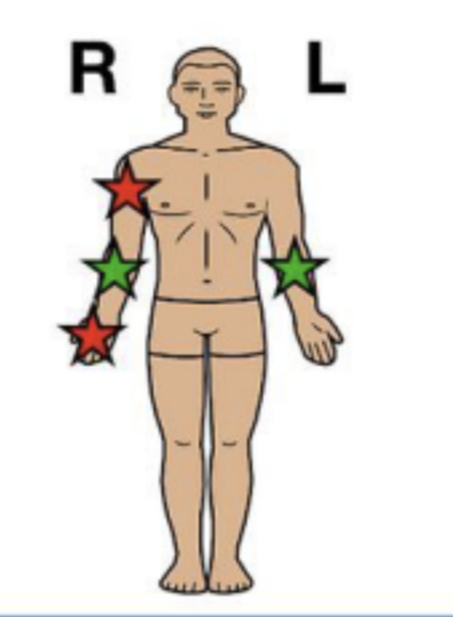<p>on the same side of the body</p><p>"ipsi" = same</p><p>RED</p>