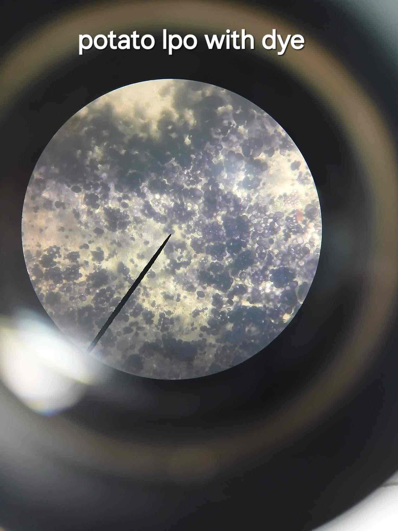 <p>A storage structure that develops within the colorless plastid known as leucoplast.</p>