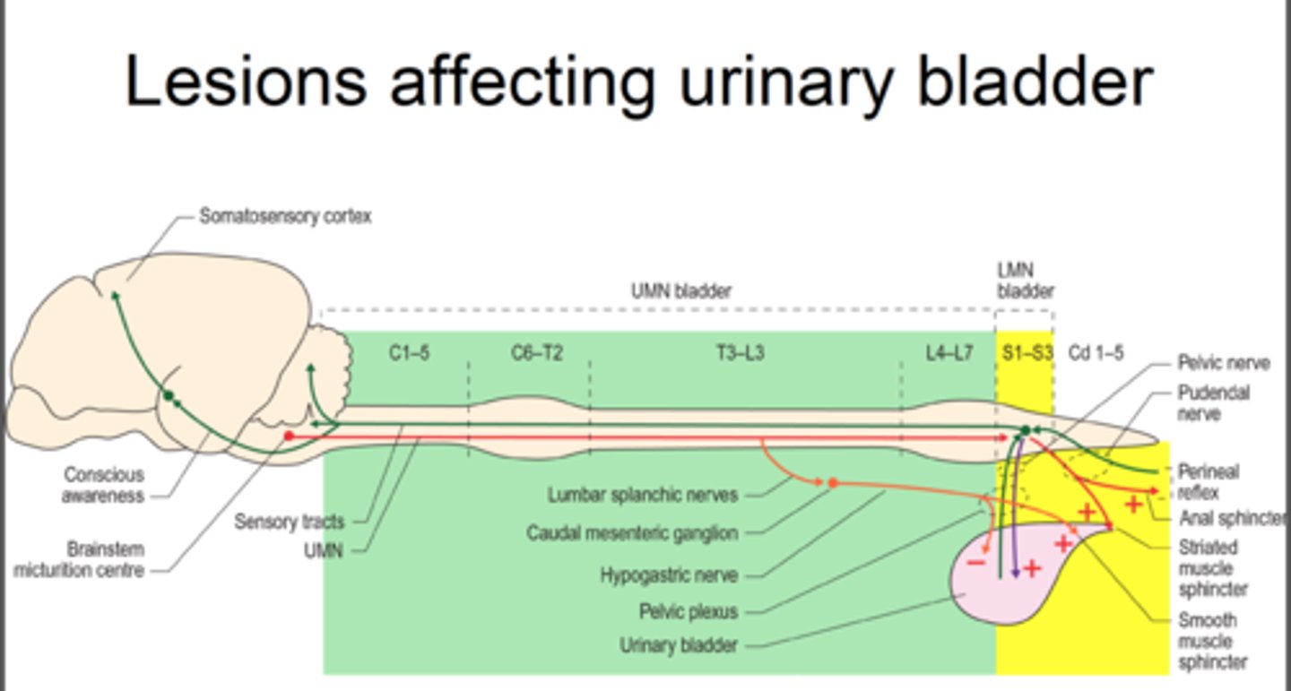 <p>-Spastic or hyperreflexic bladder</p><p>-Lesion: Above conus medullaris and sacral segments (T11-T12 and above)</p><p>-Bladder will reflexively empty in response to certain level of filling pressure</p><p>-Dyssynergia: detrusor is hyperreflexive but sphincter may have increased tone</p><p>Tx: Intermittent cath, indwelling cath</p>