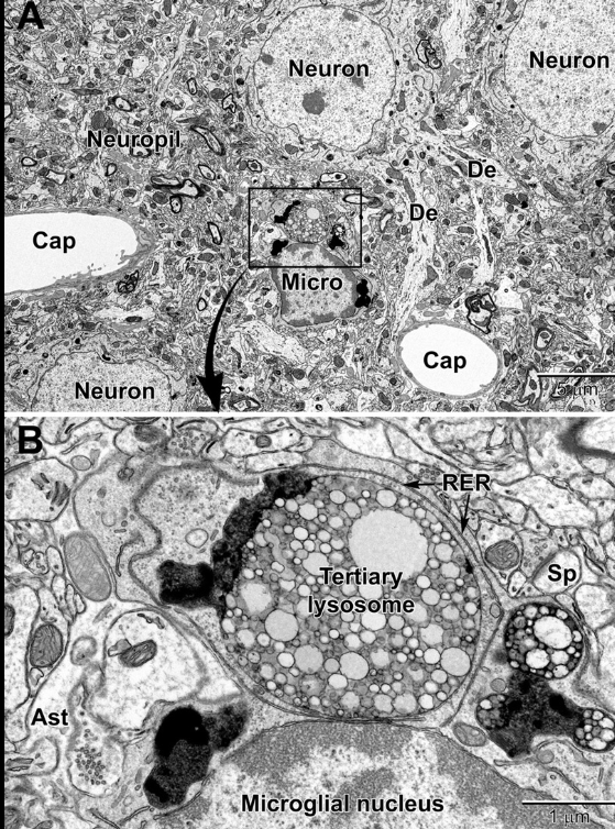 <p>Electron Microscopy</p>