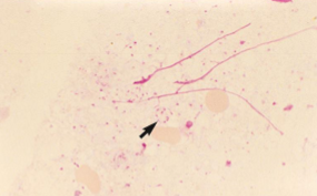 <p>Which sp is this? Which stain is it in?</p>