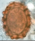 <p>Thick walled, single celled egg ± protein coat</p>