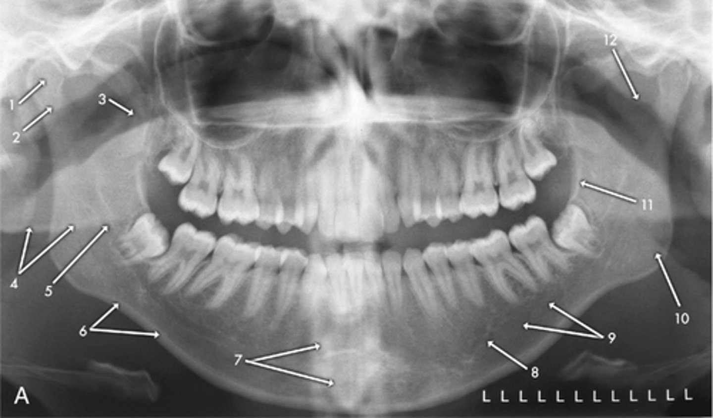 <p>number 3</p>