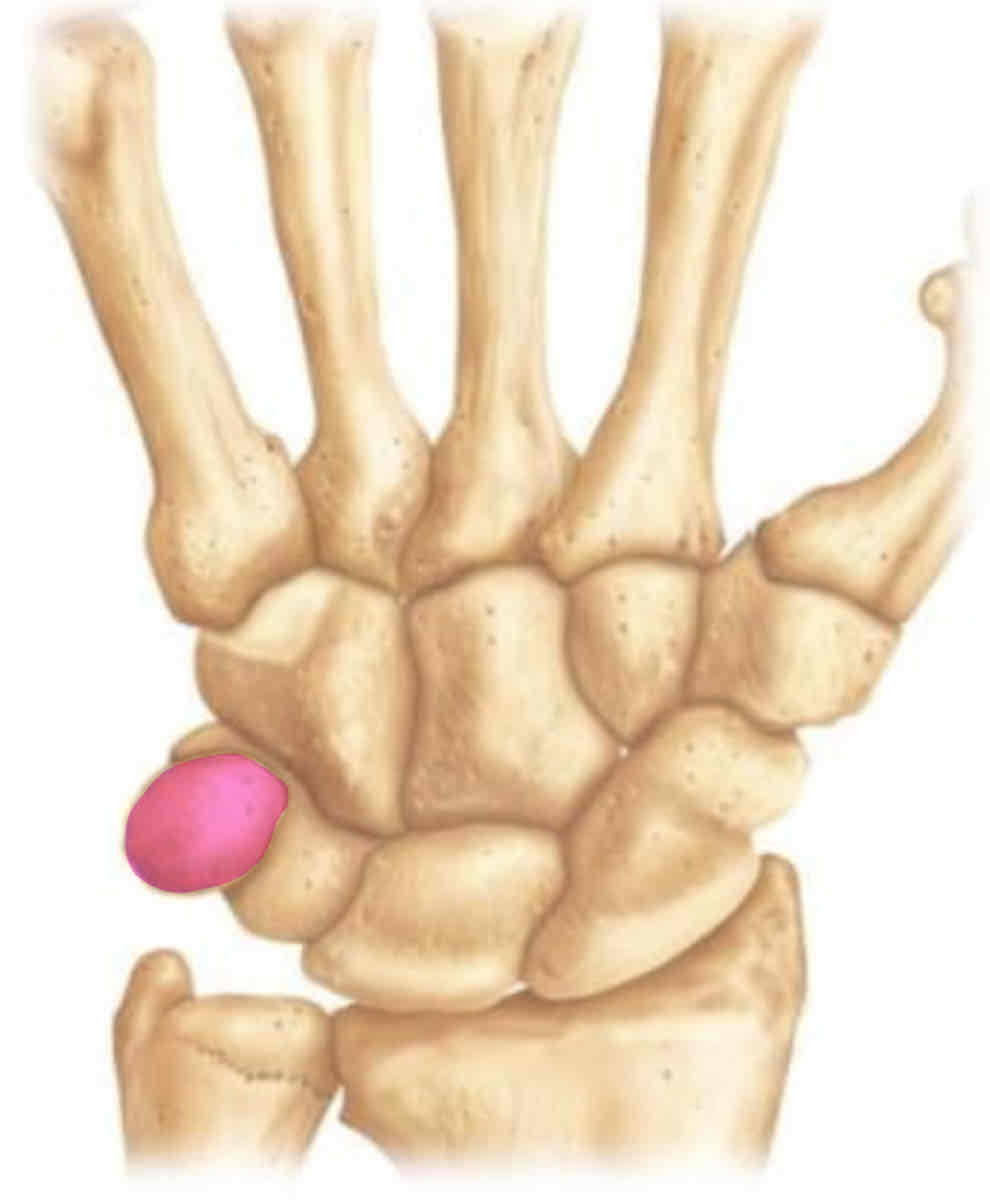 term image