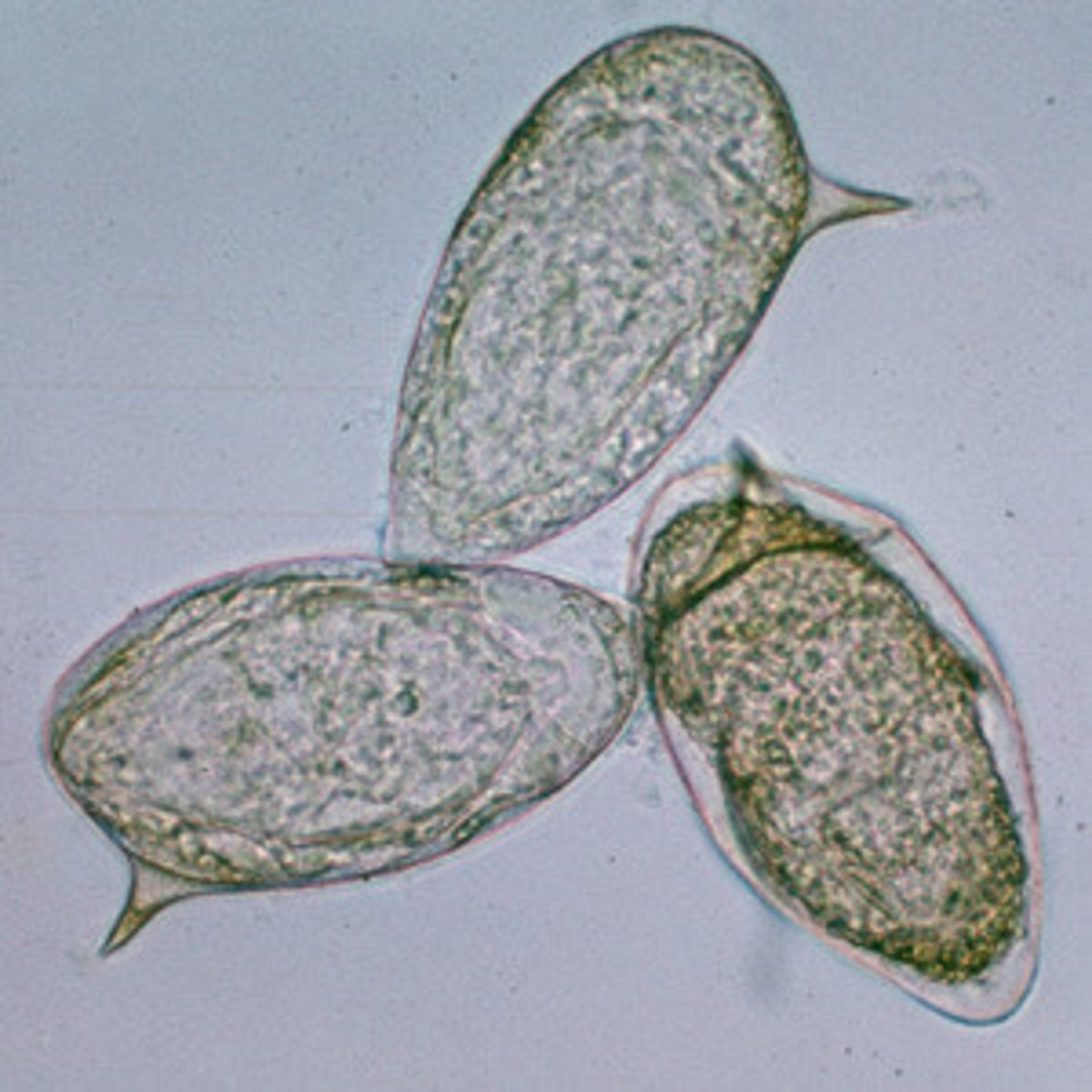 <p>eggs in stool/urine, ELISA; water sanitation, mass antiparasitic therapy of a community, control of water snail population</p>