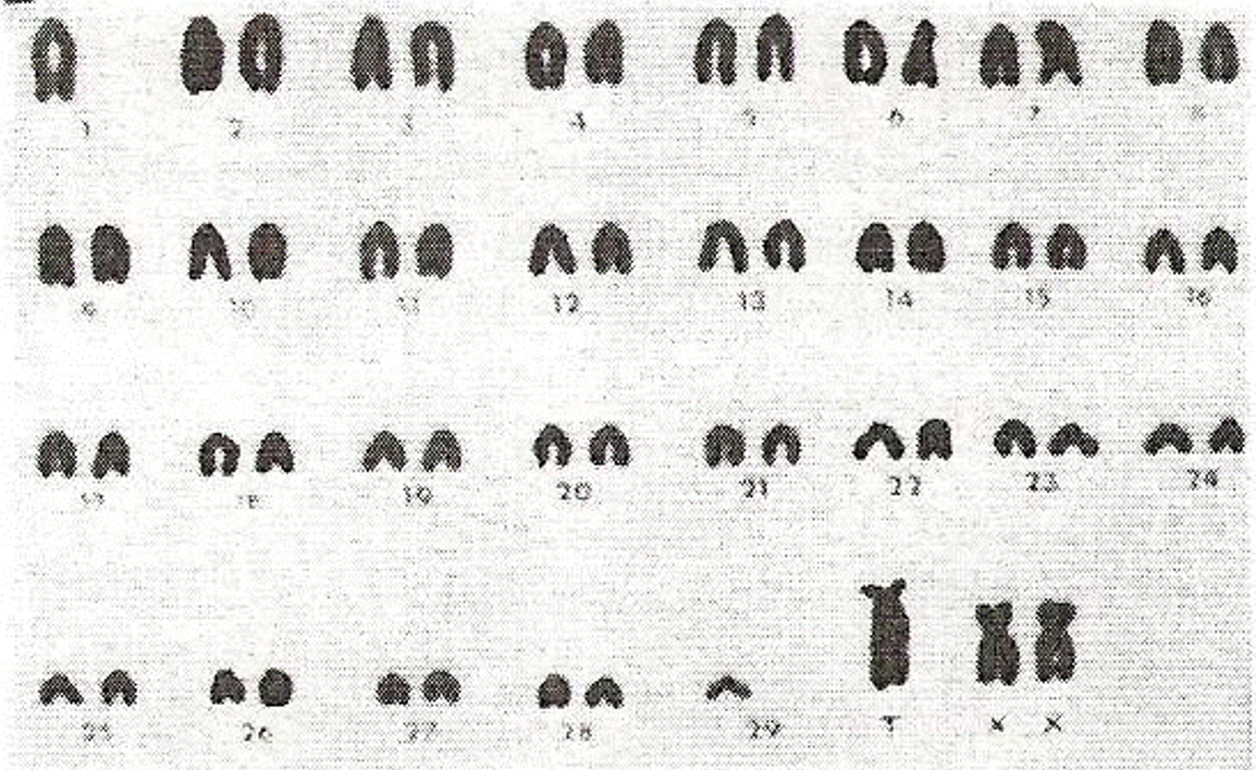 <p>Describe the <span style="color: #c500ff"><strong>karyotype</strong></span><strong> </strong>of a<span style="color: #c500ff"> <strong>robertsonian translocation cow</strong></span></p>